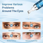 Caffeine Eye Serum for Dark Circles - Under Eye Cream,Moisturizing Serum for Dark Circles, Puffiness & Fine Lines, Eye Cre...
