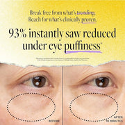 Derma E Vitamin C Bright Eyes Hydro Gel Under Eye Patches (5 Pairs), Allantoin, Caffeine & Vitamin B3, Eye Masks to Helps ...
