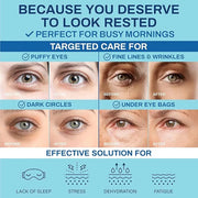 Under Eye Patches for Puffy Eyes and Dark Circles – Hydrating Eye Mask with Hyaluronic Acid Collagen & Caffeine – Skin Car...