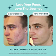 Proactiv 3 Step Acne Treatment w/ Pimple Patches - Benzoyl Peroxide Face Wash, Repairing Acne Spot Treatment for Face and ...