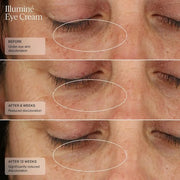 Senté Illuminé Eye Cream | Diminish Dark Circles, Discoloration, Redness, and Puffiness Around The Eyes | with Patented HS...