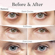 Rose Under Eye Patches (30 Pairs) Under Eye Patches for Dark Circles, Under Eye Patches for Puffy Eyes and Dark Circles, U...