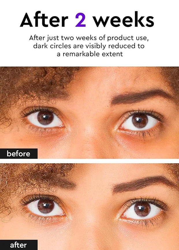 Bewants under eye cream for dark circles, cream stick for puffiness, bags, and wrinkles, Korean skincare solution for tire...