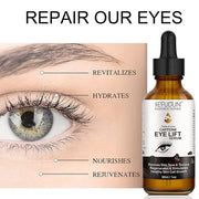 Caffeine Eye Serum + EGCG, Eye Serum for Dark Circles and Puffiness, Under Eye Serum Reduces Puffiness, Dark Circles, Unde...