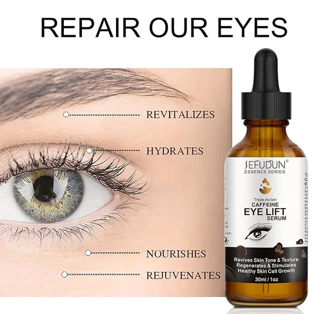 Caffeine Eye Serum + EGCG, Eye Serum for Dark Circles and Puffiness, Under Eye Serum Reduces Puffiness, Dark Circles, Unde...