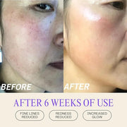 Mudita Earth Squalane Anti Aging Skin Cream, Rich Moisturizer for Aging & Dry Skin, Hyaluronic Acid, Squalane for Dark Spo...