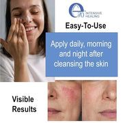 Rosacea serum - redness relief