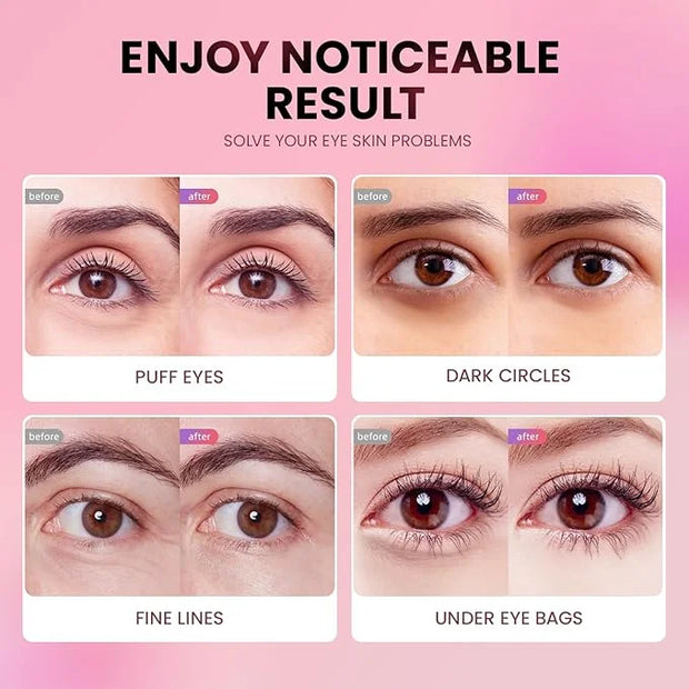 Under Eye Patches (48 Pairs) - New Tri-color Glitter Eye Gel Pads for Dark Circles Puffy Eyes,Under eye Bags,Wrinkles|Natu...
