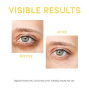Dark Circle Remover Eye Serum, Eye Bags Treatment for Men and Women, Vitamin C, Niacinamide, Ceramide, Vegan Under Eye Tre...