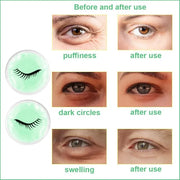 Face Eye Masks for Dark Circles and Puffiness, Migraines, Headache, Stress, Redness, Acne, Cooling Face Masks for Women Ma...