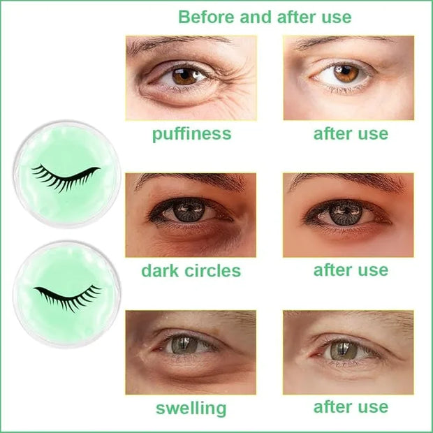 Face Eye Masks for Dark Circles and Puffiness, Migraines, Headache, Stress, Redness, Acne, Cooling Face Masks for Women Ma...