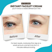 Instantly Ageless - Instant Face Lift Cream - Skin Care for Anti Aging face cream - Instant Under Eye Bags Remover - Facel...