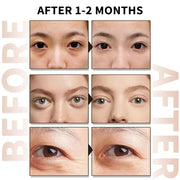 Caffeine Eye Serum With EGCG For Dark Circles and Puffiness, Anti Aging 5% Caffeine Solution For Puffy Eyes, Fine Lines, M...