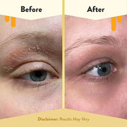 ECZEMA HONEY Multi Peptide Eye Cream & Nourishing Face Serum - Bundle for Sensitive & Dry Skin - Cruelty Free - Product Image