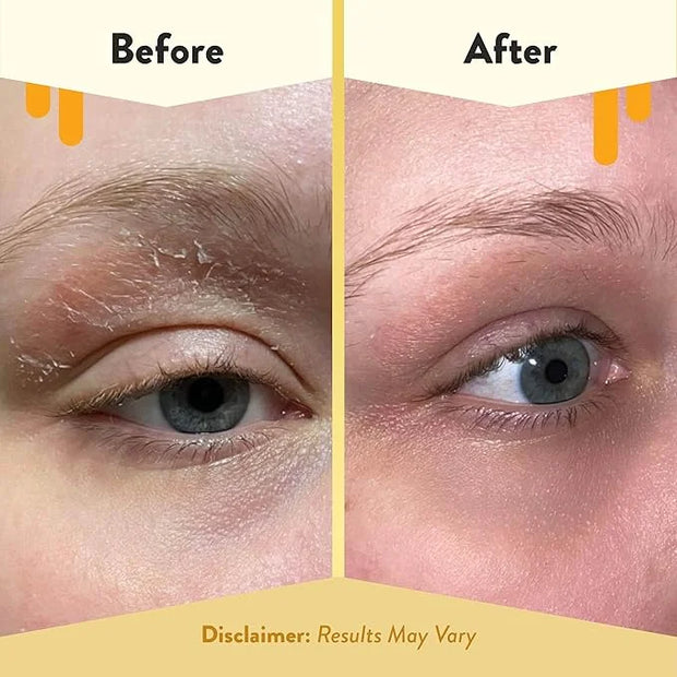 ECZEMA HONEY Multi Peptide Eye Cream & Nourishing Face Serum - Bundle for Sensitive & Dry Skin - Cruelty Free - Product Image