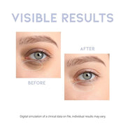 Korean Eye Serum for Under Eye Hydrating, Anti-aging Wringkles Firming Puffy Eye Bags Dark Circle, Hyaluronic Acid, Vitami...