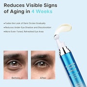 Eye Serum for Dark Circles and Puffiness, 5% Caffeine 8% Retinol Under Eye Cream with Build-In 3D Roller Applicator, Hyalu...