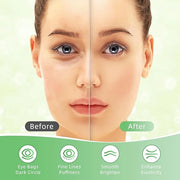 Under Eye Patches, 40 Pairs Eye Mask for Dark Circles, Puffy Eyes, Undereye Bags,Wrinkles,Eye Mask Patches with Aloe Vera,...