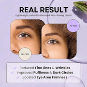 Excuse My Frank Bakuchiol Age Defense Eyecream, Korean Eye Cream, Gentle Cream, Natural Retinol, Dark Circles Puffiness & ...