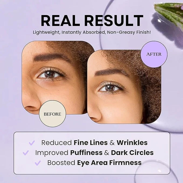 Excuse My Frank Bakuchiol Age Defense Eyecream, Korean Eye Cream, Gentle Cream, Natural Retinol, Dark Circles Puffiness & ...