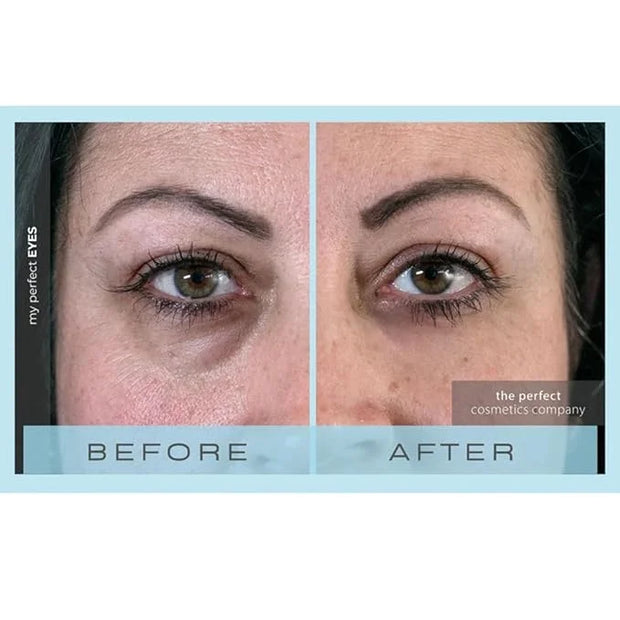 My Perfect Eyes by Penny Lane | Anti-Aging Eye Cream for Dark Circles & Puffiness | Instant Firming Treatment for Wrinkles...
