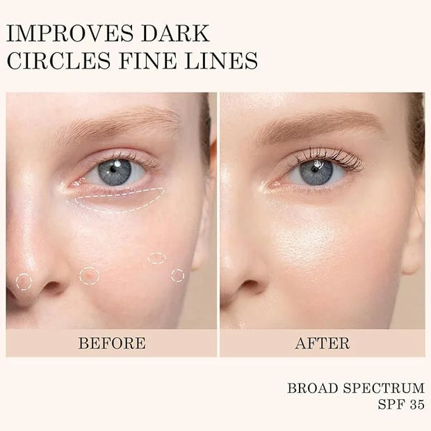 KYDA Mineral Sunscreen Eye Cream, 3-in-1 Anti-Aging Eye Cream, SPF 35, for Dark Circle and Fine Lines, Light - Product Image