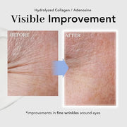 NOWATER Collagen Eye Cream for Wrinkles, Puffiness, Dark Circles - Hydrolyzed Collagen & Beta-glucan for Improved Under-ey...