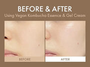 Dr.Ceuracle Vegan Kombucha Tea Gel Cream - Korean Skincare Lightweight Watery Hydrating Moisturizer with Kombucha Tea Extr...