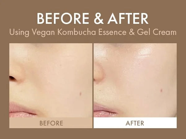 Dr.Ceuracle Vegan Kombucha Tea Gel Cream - Korean Skincare Lightweight Watery Hydrating Moisturizer with Kombucha Tea Extr...
