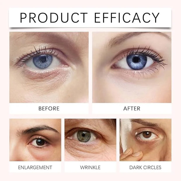 PDRN Pink Peptide Eye Serum Cream, Hydrating & Firming Eye Cream for Dark Circles, Anti-Aging Treatment Reduces Fine Lines...