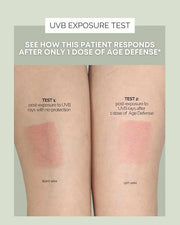 Inner Glow Age Defense Vitamins - Dermatologist and Plastic Surgeon Developed to Fight photoaging and Melasma, Polypodium ...