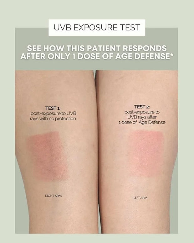 Inner Glow Age Defense Vitamins - Dermatologist and Plastic Surgeon Developed to Fight photoaging and Melasma, Polypodium ...