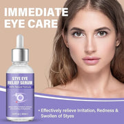 Stye Eye Treatment, Natural Stye Relief Serum, Gently Cleanses Lashes and Eyes, Chalazion and Blepharitis Treatment，Reliev...
