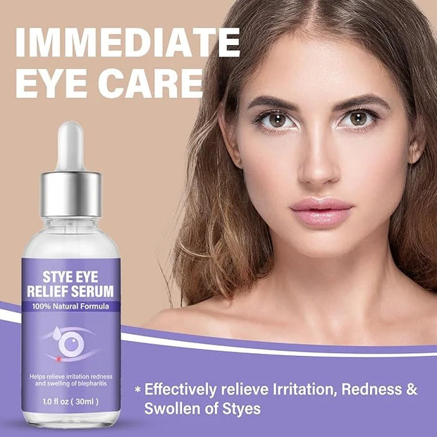 Stye Eye Treatment, Natural Stye Relief Serum, Gently Cleanses Lashes and Eyes, Chalazion and Blepharitis Treatment，Reliev...