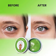 ABC Under Eye Mask for Puffy Eyes and Dark Circles - Hydrating Eye Mask Skincare, Eye Gel Pads for Eye, Reduce Wrinkles an...