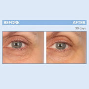 Serious Skincare - Eyetality PM Eye Night Cream with Resveratrol - Keratin & Lash Boosting Peptides for Thicker, Longer La...