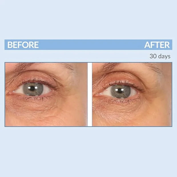 Serious Skincare - Eyetality PM Eye Night Cream with Resveratrol - Keratin & Lash Boosting Peptides for Thicker, Longer La...