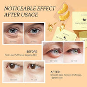 Under Eye Patchs 24k Gold Eye Mask and Hyaluronic Acid and Rose for Dark Circles and Puffiness Wrinkle Eye Bags 30 Pairs -...