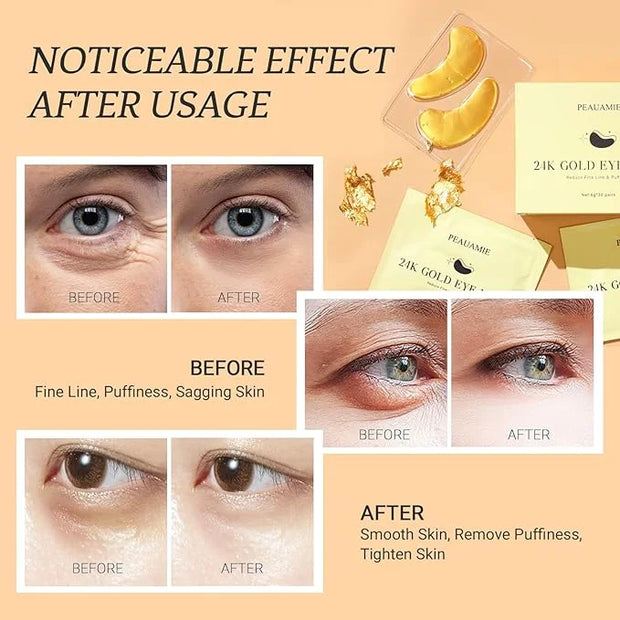 Under Eye Patchs 24k Gold Eye Mask and Hyaluronic Acid and Rose for Dark Circles and Puffiness Wrinkle Eye Bags 30 Pairs -...