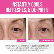 Vibriance Eye Renewal Serum - Dark Circles and Puffiness Treatment - Caffeine Formula for Reducing Bags - Product Image