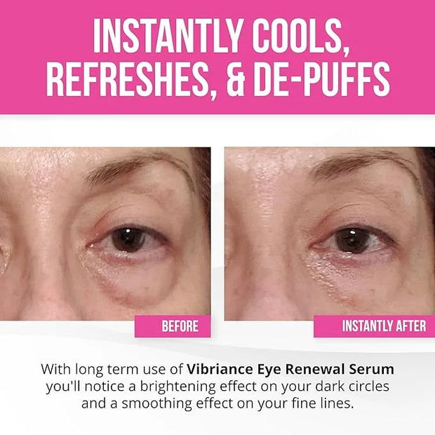 Vibriance Eye Renewal Serum - Dark Circles and Puffiness Treatment - Caffeine Formula for Reducing Bags - Product Image