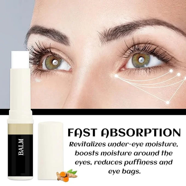 2PCS Eye Balm For Under Eye Bags, Turmeric Eye Bag Cream For Dark Circles, Dark Circles Under Eye Treatment, Eye Balm For ...