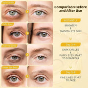 Under Eye Patches for Puffy Eyes and Dark Circles, 20 Pairs Eye Mask with Hyaluronic Acid & Collagen, Anti Wrinkle Patches...