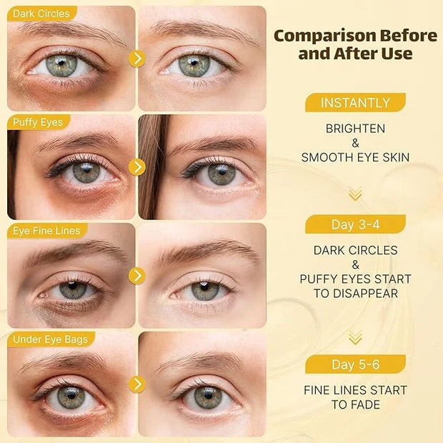 Under Eye Patches for Puffy Eyes and Dark Circles, 20 Pairs Eye Mask with Hyaluronic Acid & Collagen, Anti Wrinkle Patches...