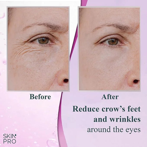 Elite Serum 10 - Natural Anti Aging Eye Serum and Anti Wrinkle Treatment - Eye Bags and Dark Circles Remover with Advanced...