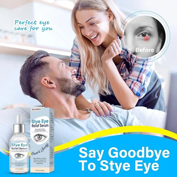 Stye Eye Treatment, Natural Stye Treatment Serum for Styes Chalazion and Blepharitis, Mild & Fast Relief - Product Image