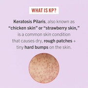 First Aid Beauty - Bye Bye Bumps Kit: KP Bump Eraser Body Scrub, 4 oz, Smoothing Lotion, 1oz, and Ingrown Hair Pads, 28 Pa...