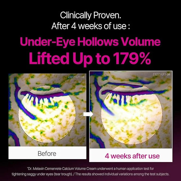 CEMENRETE EYE CREAM - Product Image