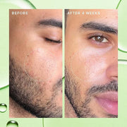 Farmacy 2% Salicylic Acid Toner for Face - Deep Sweep Gentle BHA Exfoliant for Oily Skin - Refines Texture with Papaya Enz...