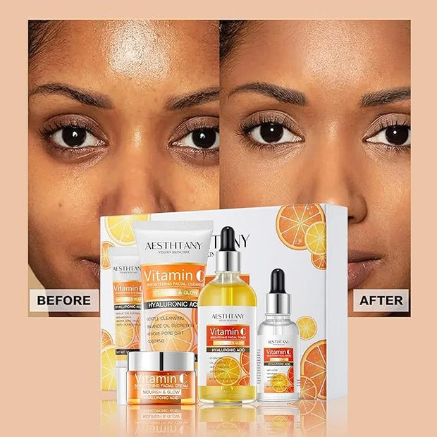 Vitamin C Skin Care Set Moisturizing Hyaluronic Acid Skin Care Kit 5PCS For Women Beauty Set Gift Set - Product Image